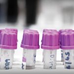 Laboratory tests are invaluable medical tools…if the results are reliable. Aside from sample collection and handling, many other factors can affect test outcomes, from patient stress to client misunderstanding. This article addresses the seemingly unimportant details that can have significant effects.