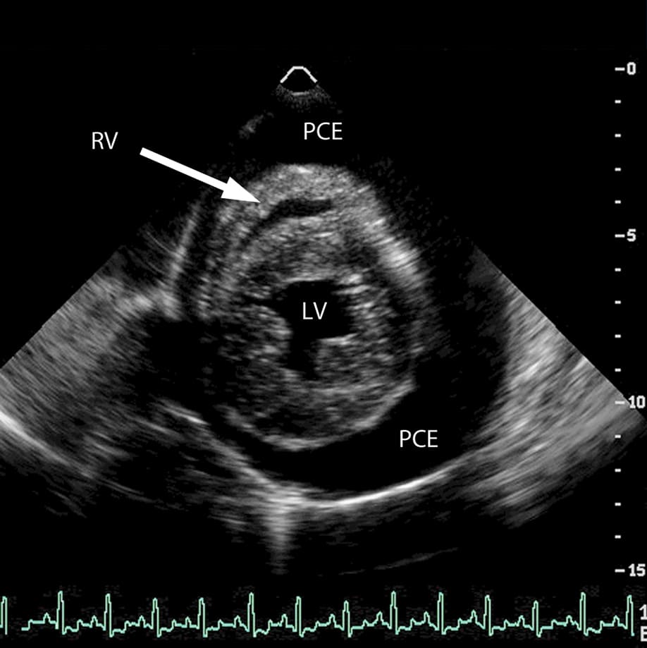 Body Cavity Centesis: Techniques for the Pleural, Abdominal, and ...