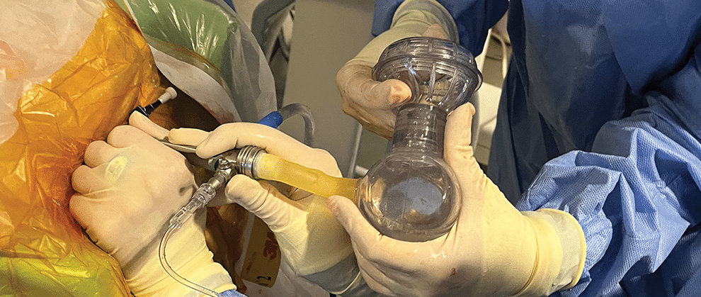 Noninvasive Methods for Removing Cystoliths in Small Animals - Featured Image
