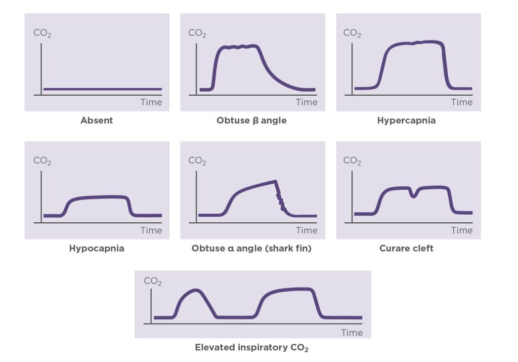 A Guide to Capnography in Small Animal Anesthesia | Today's Veterinary ...